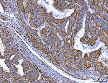 MTSS1 Antibody / MIM / Missing in metastasis