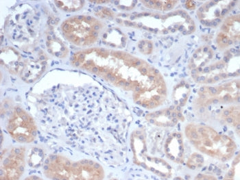 GCLM Antibody / Glutamate-Cysteine Ligase Regulatory Subunit