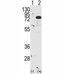 Western blot analysis of PKC beta antibody and 293 cell lysate either nontransfected (Lane 1) or tra