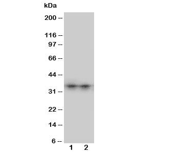 Aquaporin 8 Antibody