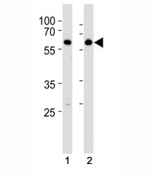 HDAC2 Antibody
