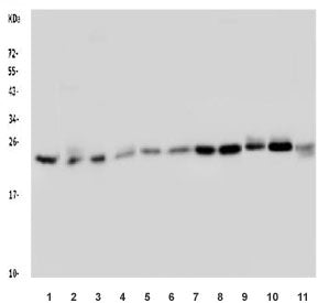 Western blot testing of human 1) HeLa, 2) placenta, 3) A549, 4) A375, 5) SW620, 6) U-2 OS, 7) HEK293