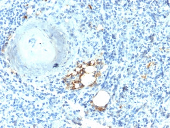 IHC testing of FFPE human spleen with recombinant TRAcP antibody (clone ACP5/2336R). Required HIER: 