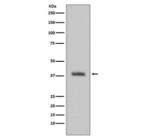 HTRA2 Antibody / Omi