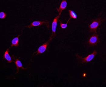 CTCF Antibody