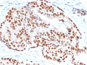 NKX3.1 Antibody