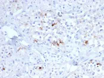 IHC staining of FFPE human pituitary tissue with FSH beta antibody (clone FSHB/6845). HIER: boil tis
