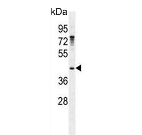 Western blot testing of human NCI-H460 cell lysate with Growth arrest-specific protein 1 antibody. P