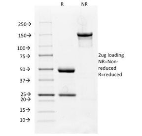 VEGF Receptor 1 / VEGFR1 Antibody / FLT1