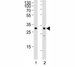 Western blot analysis of lysate from (1) HeLa and (2) SiHa cell line using SNAI1 antibody at 1:1000.
