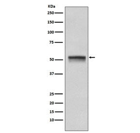 Western blot testing of human HeLa cell lysate with CHEK1 antibody. Predicted molecular weight ~54 k