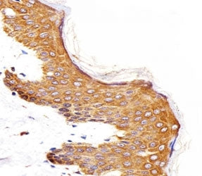 IHC analysis of FFPE human skin section using Epidermal Growth Factor Receptor antibody; Ab was dilu