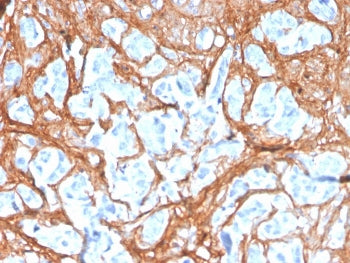 Periostin Antibody