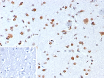 Nucleophosmin Antibody / NPM1