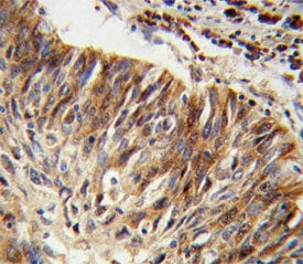 ALDH3B1 Antibody