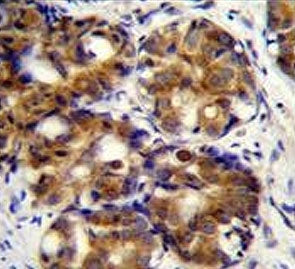 CD168 Antibody / HMMR