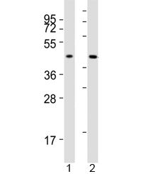 Western blot testing of ACAT1 antibody at 1:2000 dilution. Lane 1: human SW620 lysate; 2: mouse live