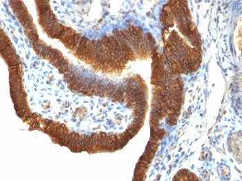 EpCAM Antibody
