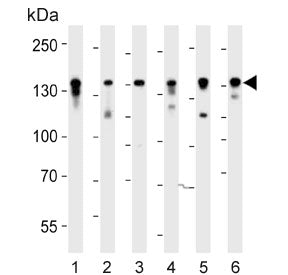 Ctr9 Antibody