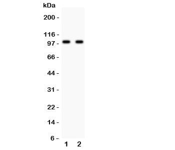 Glutamate receptor 3 Antibody