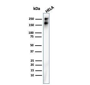 Western blot testing of human HeLa cell lysate with recombinant Spectrin beta III antibody. Predicte