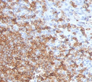 CD105 Antibody / Endoglin