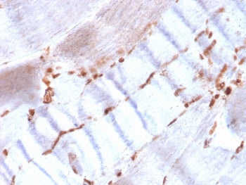 Recombinant Actin Antibody / ACTA2 / Smooth Muscle