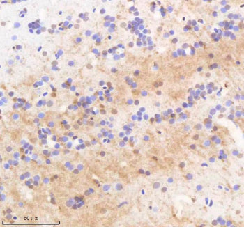 IHC staining of FFPE zebrafish brain tissue with Twist antibody, HRP-labeled secondary and DAB subst