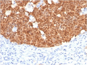 p16INK4a Antibody / CDKN2A