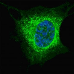 Vimentin Antibody