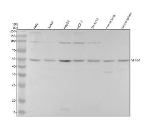 Western blot testing of human and mouse samples using the SEC62 antibody at 1:1000 dilution for 1 ho