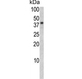 Western blot testing of human SK-BR-3 cell lysate with BGN antibody. Predicted molecular weight ~41 