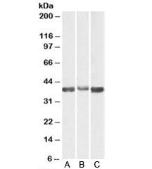 Western blot testing of A) human, B) mouse and C) rat skeletal muscle lysates with Aldolase A antibo