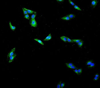 Immunofluorescent staining of FFPE human A431 cells with Tubulin Beta antibody (green) and DAPI nucl