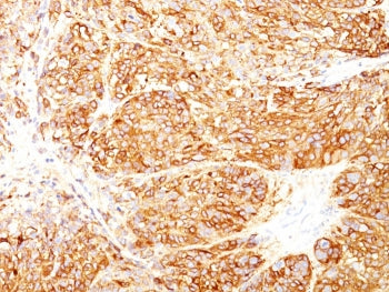 Melanoma Marker Antibody Cocktail (MART-1 &amp; gp100)