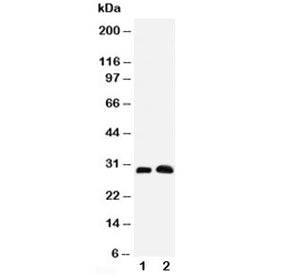 Western blot testing of Aquaporin 5 antibody and Lane 1: rat lung; 2: rat testis tissue lysate. Pred