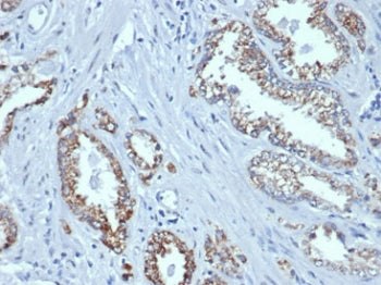 AMACR / p504S Antibody (Prostate Cancer Marker)