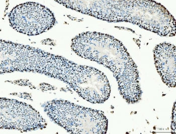 IHC staining of FFPE mouse testis tissue with MCM6 antibody. HIER: boil tissue sections in pH8 EDTA 