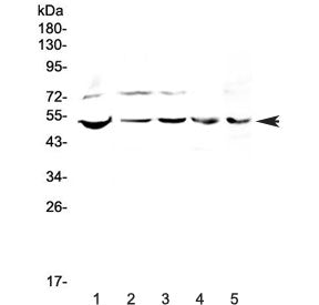 Western blot testing of human 1) PANC-1, 2) 22RV1, 3) COLO-320, 4) SW620 and 5) mouse SP20 lysate wi