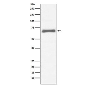 Western blot testing of human HepG2 cell lysate with AFP antibody. Predicted molecular weight ~70 kD