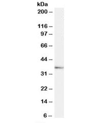 Western blot testing of human testis lysate with TACR1 antibody at 1ug/ml. Predicted molecular weigh