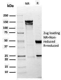SDS-PAGE analysis of purified, BSA-free recombinant Mesothelin antibody (clone MSLN/6443R) as confir