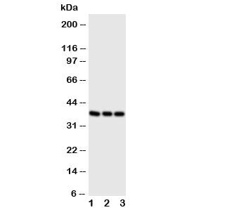 Western blot testing of CD1a antibody and Lane 1: Jurkat; 2: SW620; 3: CEM cell lysate. Predicted mo
