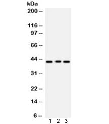 Western blot testing of 1) rat brain, 2) human COLO320 and 3) human HeLa lysate with ATXN3 antibody.