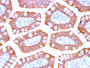 IHC staining of FFPE human colon with recombinant CK20 antibody (clone KRT20/3129R). HIER: boil tiss