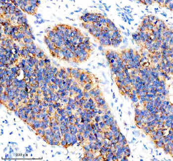 Immunohistochemical staining of CYP2W1 using anti-CYP2W1 antibody. CYP2W1 was detected in a paraffin