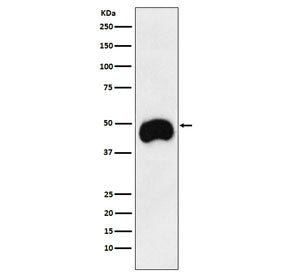 Western blot testing of human Jurkat cell lysate with CD2 antibody. Predicted molecular weight ~47 k