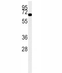 ACOX1 Antibody / Peroxisomal acyl-coenzyme A oxidase 1, 0.4ml