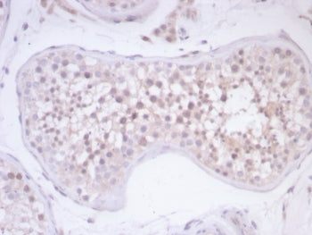 Survivin Antibody / BIRC5