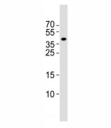 Isl1 Antibody